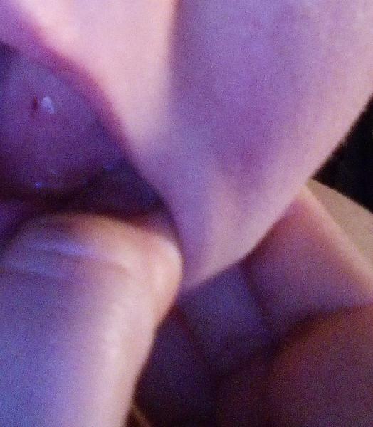 Je to podľa vás afta?