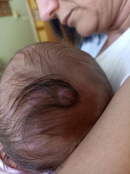 Fľak a hrčka na hlavičke