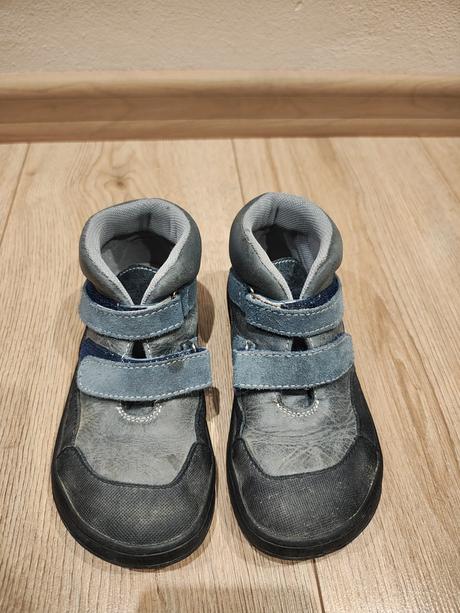 Prechodné barefood, jonap,29