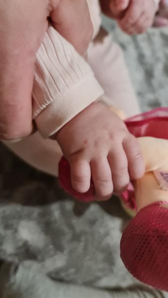 Je to kurie oko či ovčie kiahne?