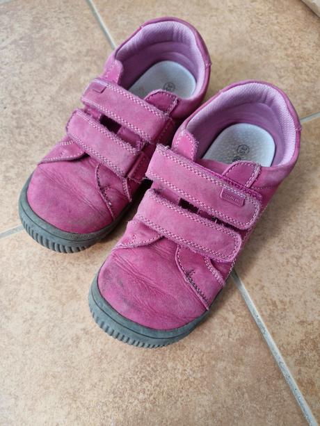 Bardfoot protika, protetika,33