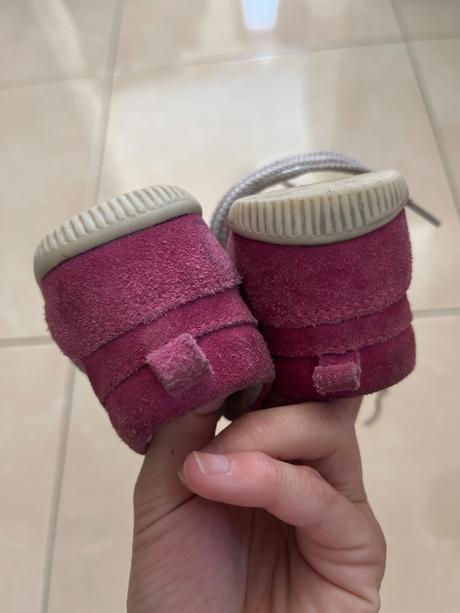 Prvé topanky, protetika,20