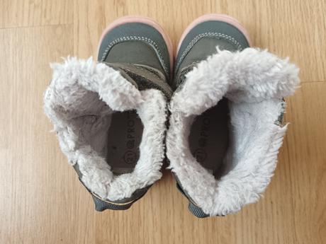 Protetika, protetika,21