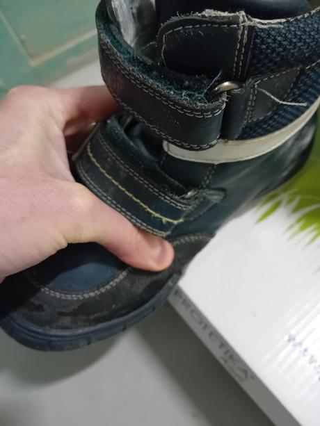 Protetika zimne topanocky, protetika,31