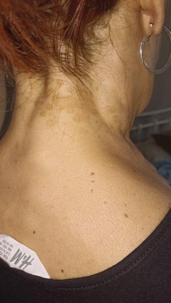 Čo to má mamina na krku a na pleci?