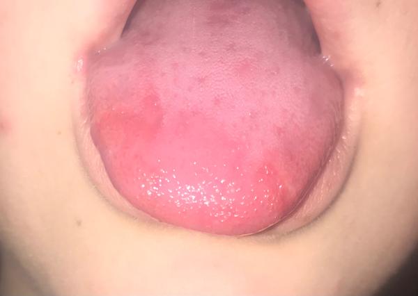 Mám niečo na jazyku