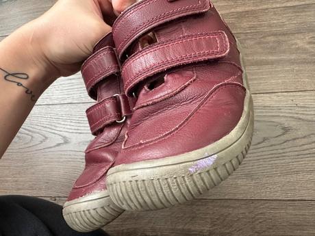 Protetika prechodné topánky, protetika,33