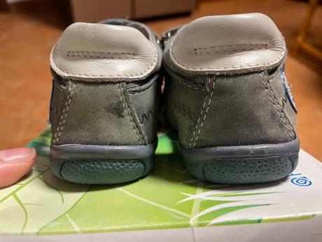 Protetika sandálky, protetika,20