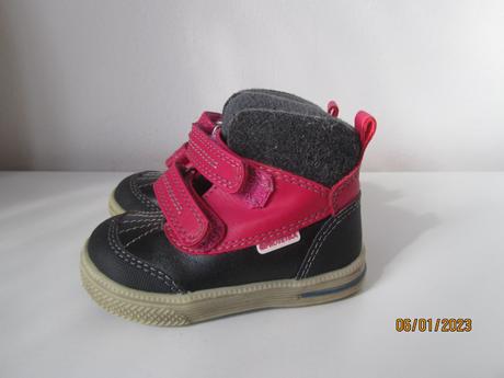 Topanky, protetika,19