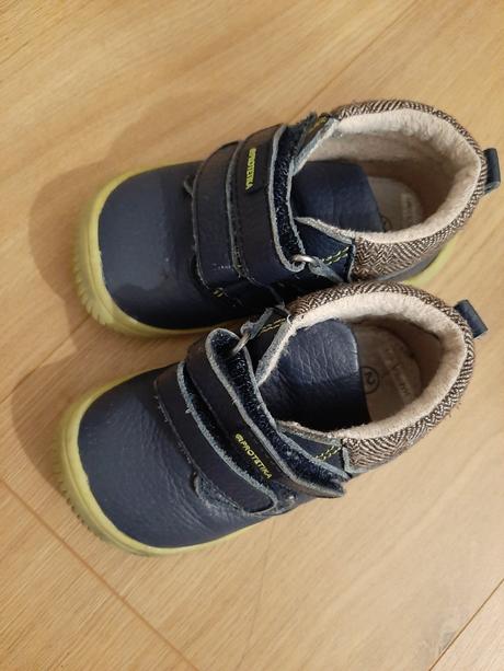 Celorocne topanky protetika, protetika,21