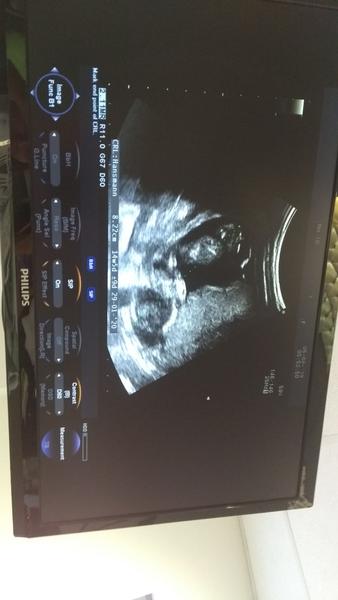 Pomôžete mi pri určení pohlavia?