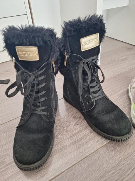 Cizmy peotetika, protetika,34