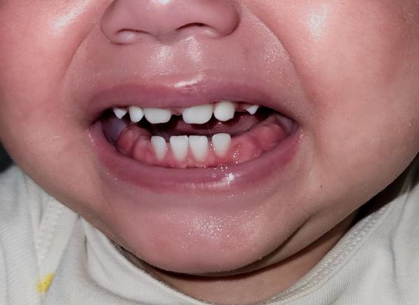 Ako pomôcť 11-mesačnej dcére, ktorá odmieta jesť?