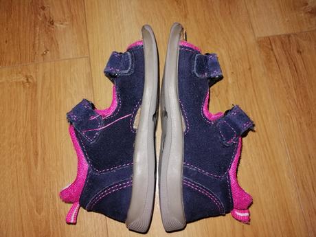 Sandalky protetika, protetika,26