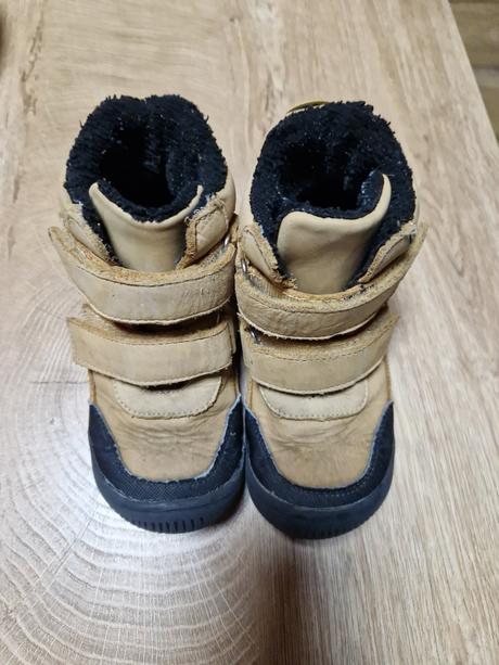 Barefoot protetika, protetika,28