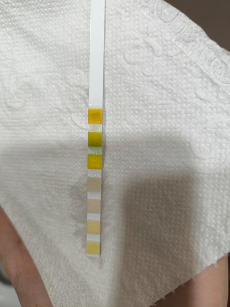 Čo spôsobuje časté močenie a bolesti v podbrušku?