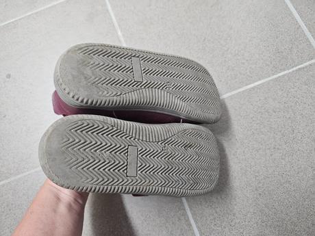 Prechodné topánky, protetika,31