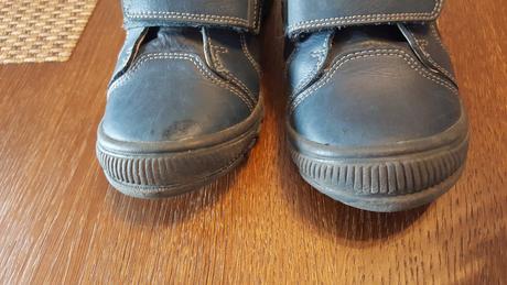 Topánky na donosenie, protetika,28