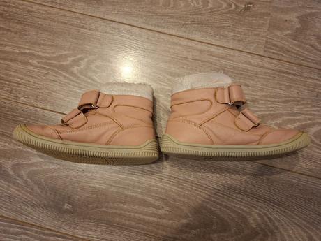 Zimne topanky protetika, protetika,32