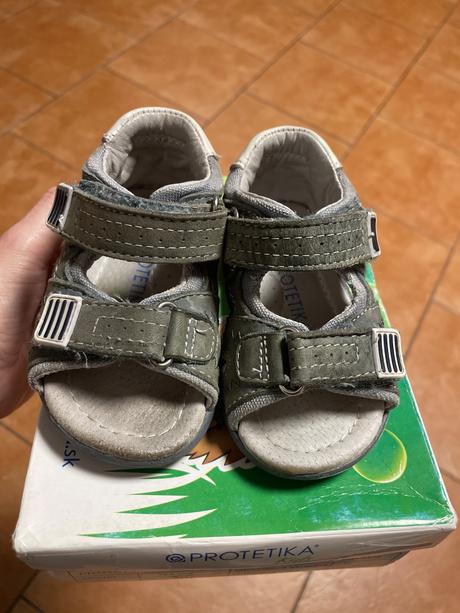 Protetika sandálky, protetika,20