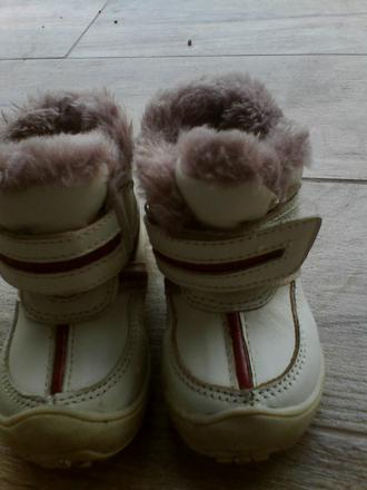 Zimne topanocky, protetika,20