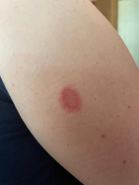 Je toto od ploštice?