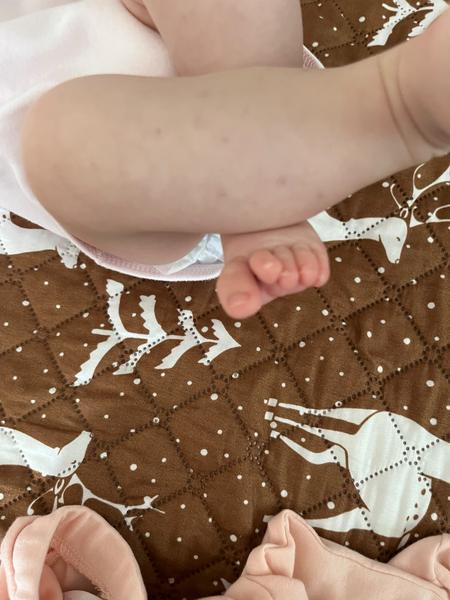 Čo to má na nôžke?