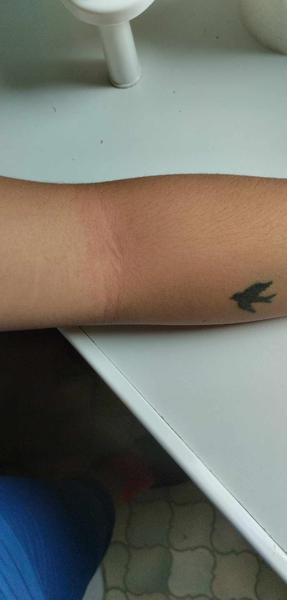 Z čoho sa mi vytvára takýto výsyp?