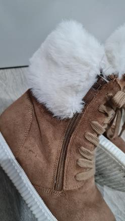 Snehule protetika, protetika,34