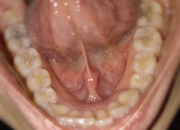 Aký útvar mám pod jazykom?