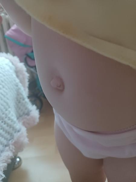 Má moja dvojročná dcérka pupočný pruh?