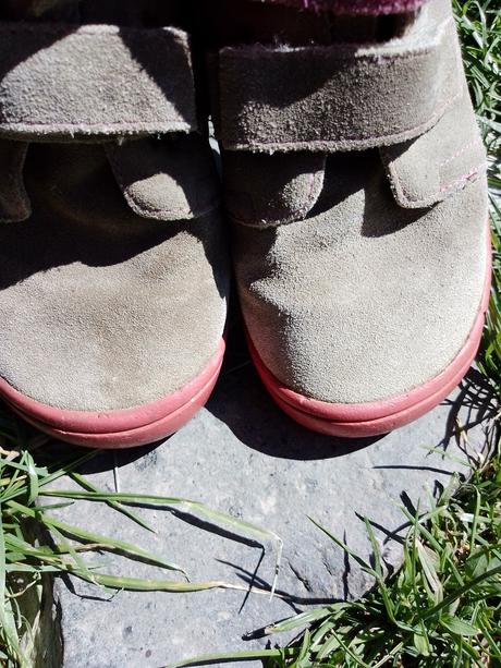 Barefoot protetika, protetika,31