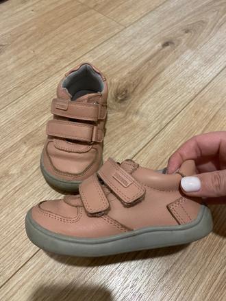 Protetika tenisky, protetika,23