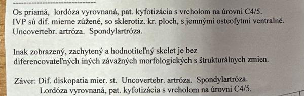 Čo znamenajú výsledky RTG krčnej chrbtice?