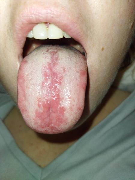 Počuli ste už o covidovom jazyku?