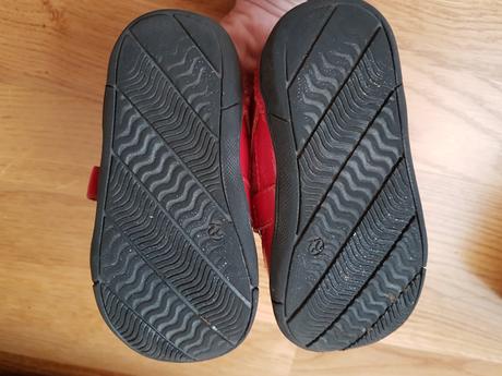 Topánočky barefoot protetika, protetika,22