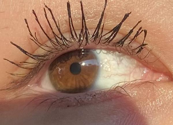 Biela bodka v oku