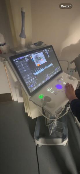 Ako zistiť, či srdce bábätka bije správne?