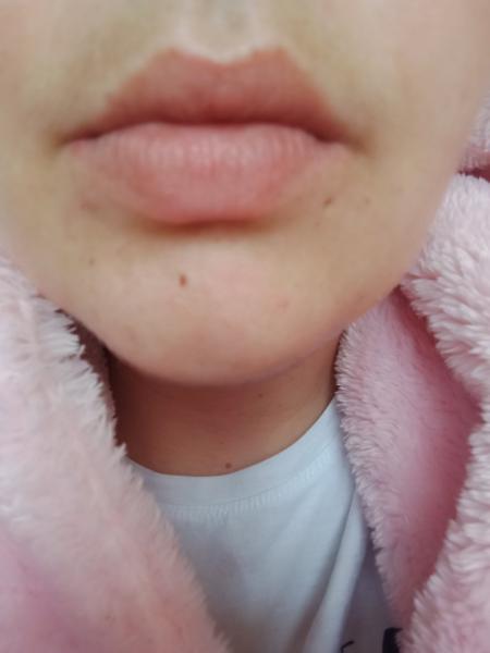 Čo je to biele nad perou?