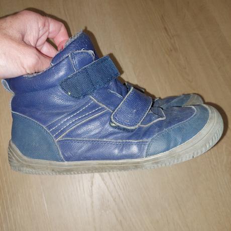 Barefoot clenkove zateplene kozene protetika, protetika,33