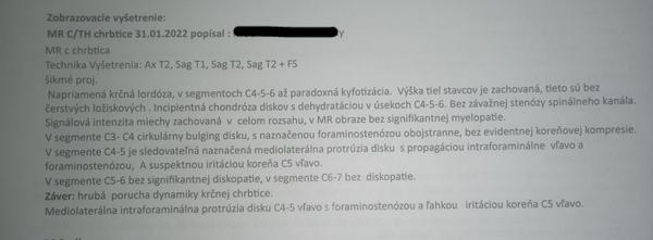 MR krčnej chrbtice - výsledky