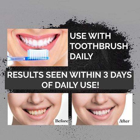 Bottokan, aktívne čierne uhlie na bielenie zubov,