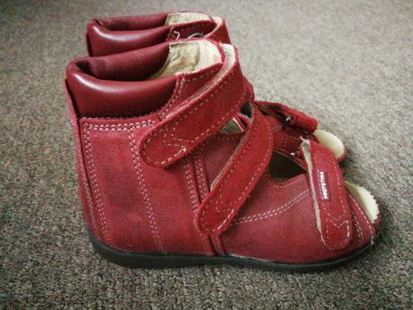 Protetika ortopedické sandále, protetika,30