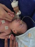 From survivor to warrior! My gastroschisis baby turned 11!!! 19/9/26 💕
