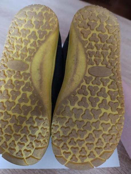 Barefoot protetika, protetika,31