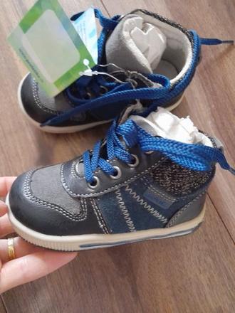 Nové topánky protetika, protetika,19