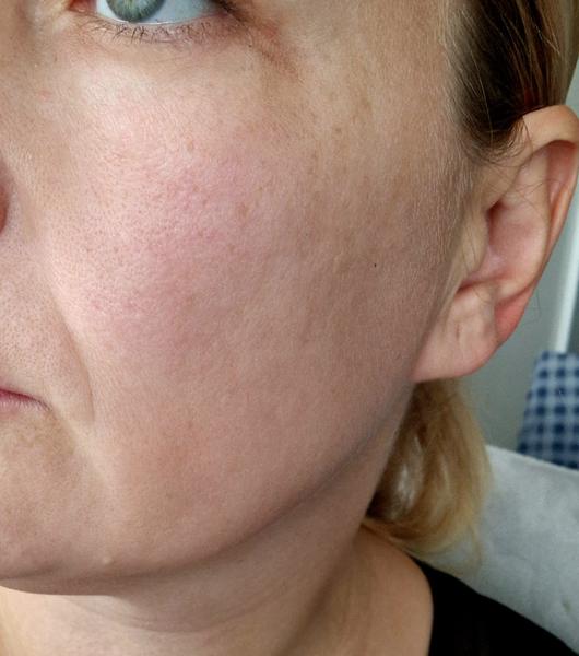 Môže bolesť hrdla súvisieť s opuchnutým lícom?