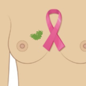 Čo robiť, keď objavíte hrčku v prsníku?