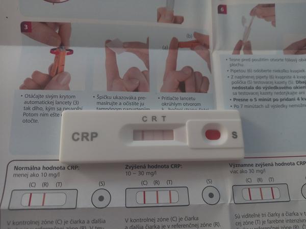 Aký je výsledok môjho CRP testu?