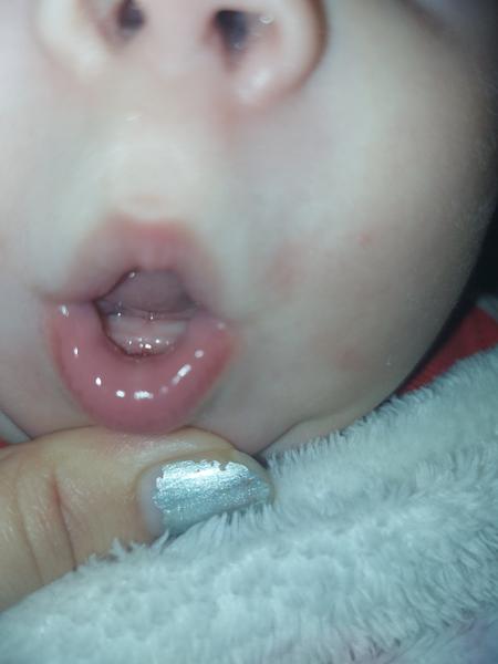 Idú môjmu dieťaťu zúbky?